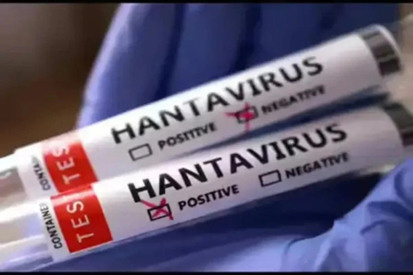 dpr-minta-pemerintah-waspadai-penyebaran-hantavirus-andes-wiz