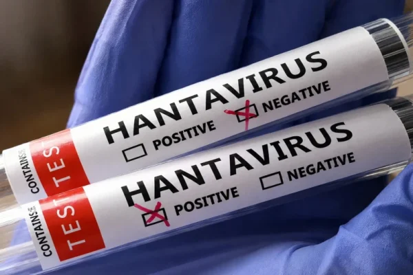 heboh-kabar-warga-singapura-diduga-kena-hantavirus-kemenkes-ungkap-hasil-tesnya-amm