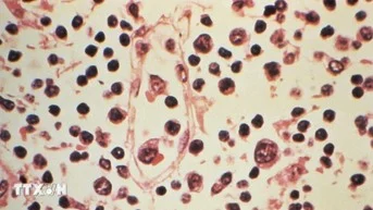 hubungan-virus-hanta-dan-warisan-ilmuwan-korsel-terungkap-gsy